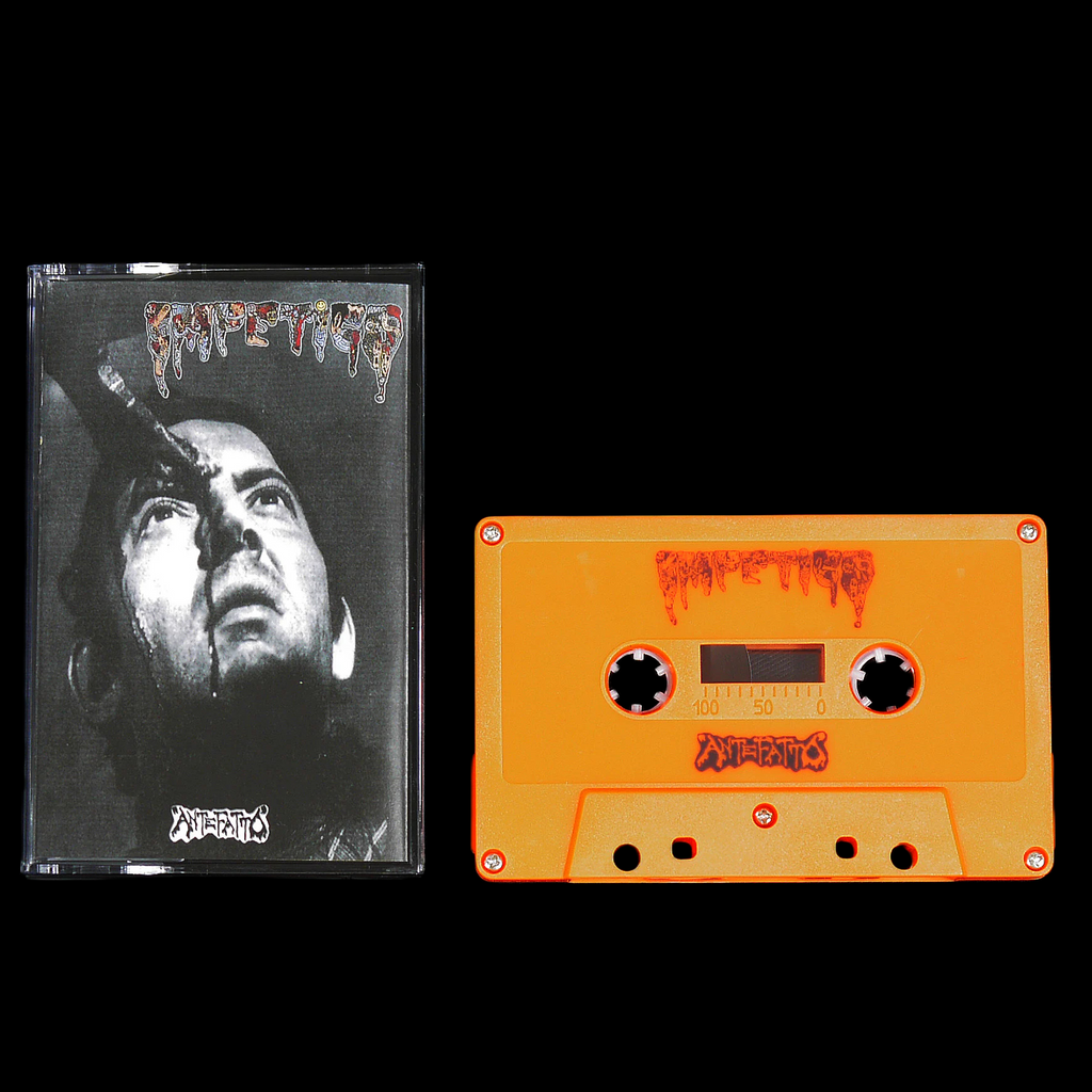 IMPETIGO - Giallo / Antefatto - MС Tape