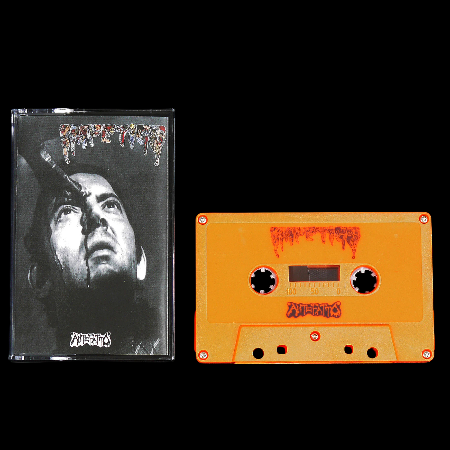 IMPETIGO - Giallo / Antefatto - MС Tape