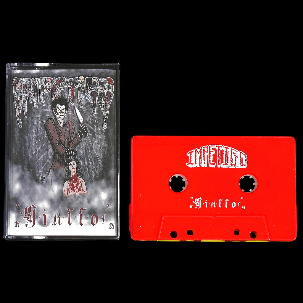 IMPETIGO - Giallo / Antefatto - MС Tape