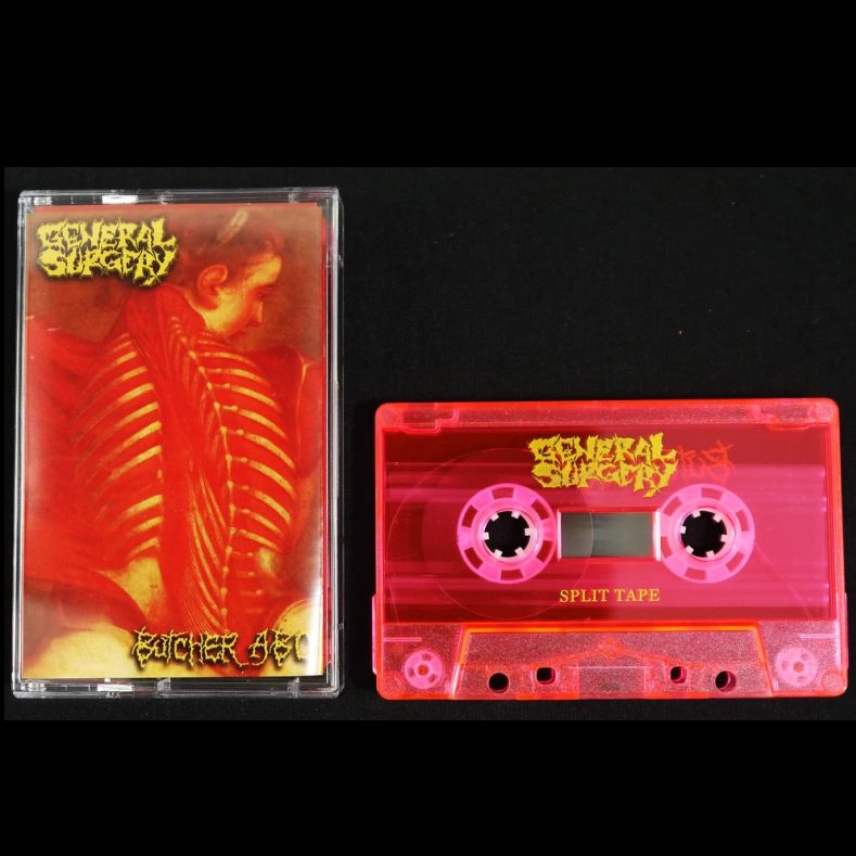 GENERAL SURGERY / BUTCHER ABC - Split MC Tape