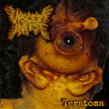 VISCERA INFEST - Teratoma (Obi Strip - Japan Import) CD
