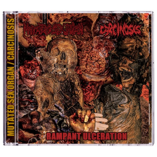 MUTATED SEX ORGAN / CARCINOSIS - Rampant Ulceration - Split CD